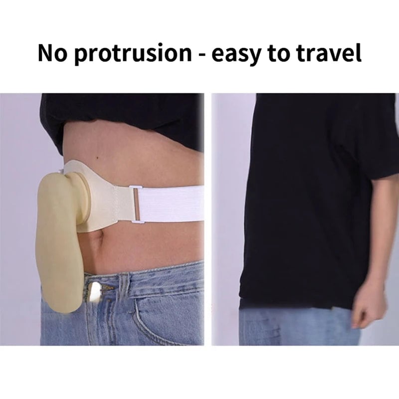 Silicone Drainable Urostomy Ostomy Pouch with Adjustable Belt
