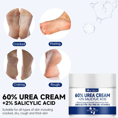 SUYARUN 60% Urea Foot Cream - Cracked Heel Repair & Callus Remover