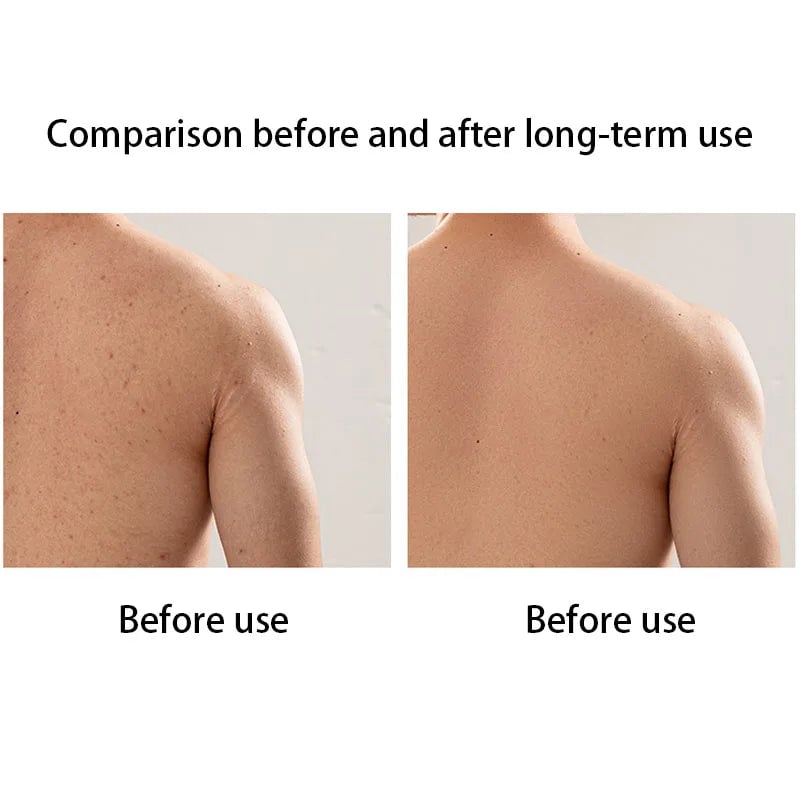Foaming Back Scrubber Long Strip Bath Towel Dead Skin Remover