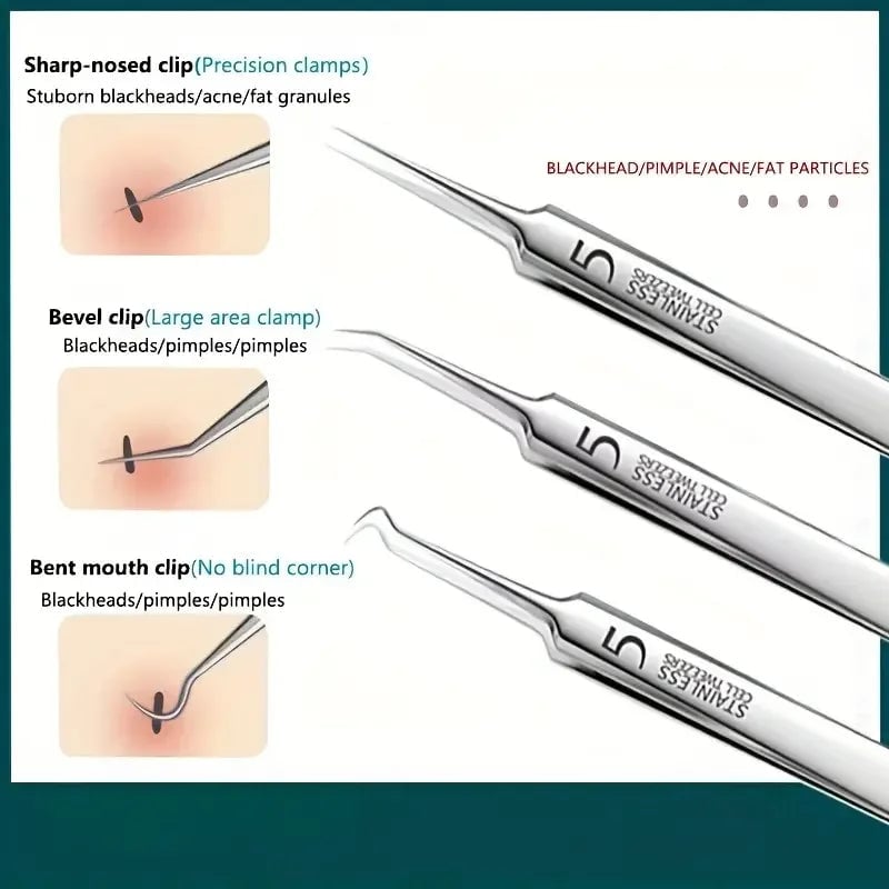 8-Piece Stainless Steel Acne Extraction Tool Kit - Professional