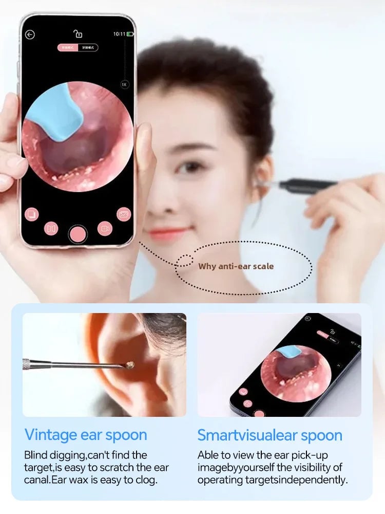 Generation-2 Visual Ear Wax Cleaner Camera Endoscope Safe Removal Tool
