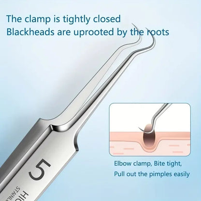 8-Piece Stainless Steel Acne Extraction Tool Kit - Professional